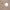 YULIKA Round Led Metal Wall Mirror 10x Magnification Makeup Mirror, Plug-In