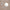 YULIKA Round Led Metal Wall Mirror 10x Magnification Makeup Mirror, Plug-In